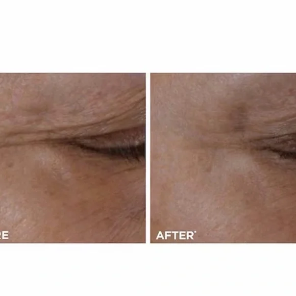 Clarins Total Eye Lift Replenishing Eye Concentrate NEW - NIB!